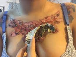 According to experts, roughly 11% of tattooed people get their tattoos removed. Uni Students Tattoo Removal Goes Horribly Wrong Stickboy Bangkok