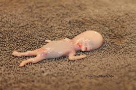 My Life As An Actuary S Wife My Miscarriage Experience Day 9