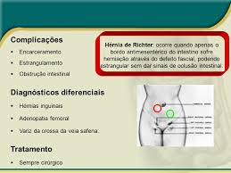 Hernia Inguinal Maio De Ppt Video Online Carregar