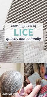 Carefully saturate your hair with the solution. How To Get Rid Of Lice Nits Without Chemicals Living Well Mom