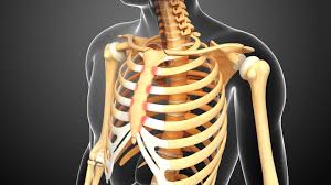 • raise rib cage for inhaling & depresses rib cage for exhaling. Rheumatoid Arthritis And Costochondritis What To Know About Chest Pain Everyday Health