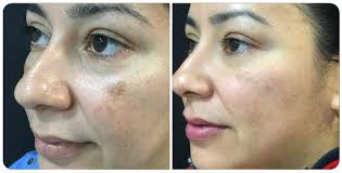 Dorsia: Clínica Cirugía Estética Sevilla Avda Ramón Carande