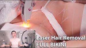 It's important to come in for a complimentary consultation and discuss exactly what your needs are. Laser Hair Removal Full Bikini Step By Step Process Using Candela Laser Dermacure Laser Clinic Youtube