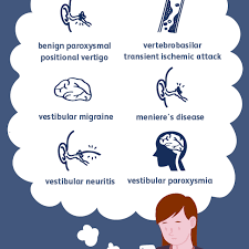 Vestibular migraines don't always cause headaches. Vertigo Overview And More