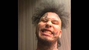 List of bosnian and herzegovinan rappers. Stitches Exposed Fight With Cancer Rapper Is Sick Takes Break From Social Media While Recovering Youtube