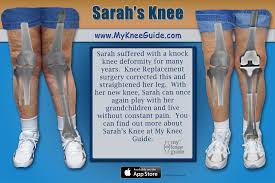My Knee Guide Timeline Photos Facebook