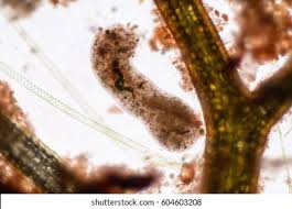 Image result for Pseudopod Ospermum