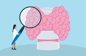 Thyroid gland, hormones and thyroid problems, animation. Thyroid Disease May Run In Your Family And You Might Not Know It Health Essentials From Cleveland Clinic