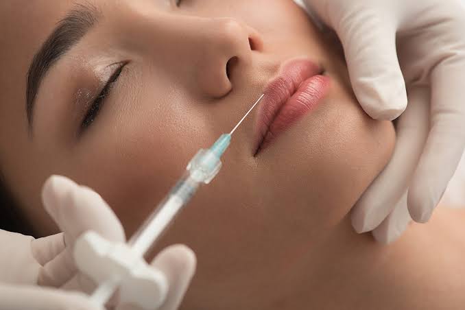 Lip Fillers Fulham | Natural-Looking Results