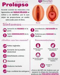 Salvia994 Sabes Que Es El Prolapso Uterino Facebook