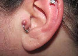 Should I Pop The Bump On My Cartilage Piercing Authoritytattoo