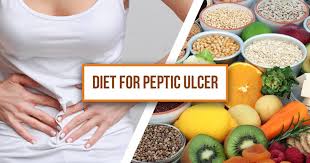 Other dietary changes related to duodenal ulcers are based on your personal tolerances. Dietary Modifications For Peptic Ulcer