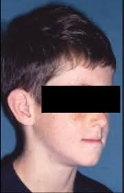 The Timing of Orthodontic Treatment