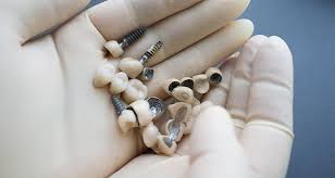 This is the reason why dental schools and organizations conduct such research programs where common people can take part in and get benefits from the same. How Much Do Dental Implants Cost