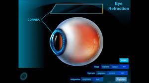 Presbyopia Part 1 Presbyopia Astigmatism Medical
