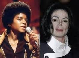 Black And White Bleaching Cream Before And After Michael Jackson White Skin Bing Images Beyonce Skin Lighten Skin Skin Bleaching