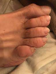 Buy other books like la mujer que tenía los pies feos / the woman who had ugly feet. Toda Mi Vida He Tenido El Dedo Pequeno Del Pie Raro Y Os Lo Muestro Foro Coches