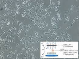 It can be carried out at a local doctor's surgery if they have the facilities, or the patient will be referred to their local a ca125 blood test should be requested if a doctor suspects a patient's symptoms could be caused by ovarian cancer. Detection Of O Glycosylated Ca125 By Using An Electrochemical Immunosensor For Ovarian Cancer Diagnosis Springerlink