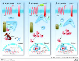 Most colon cancers develop from polyps that can turn into cancer. Targeting Wnt Signaling In Colon Cancer Stem Cells Clinical Cancer Research