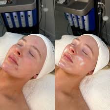 The epitome of “Self Care” before & after