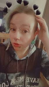 Has anyone done an eyebrow slit with an eyebrow piercing?