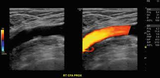 Echocardiography | Ppt