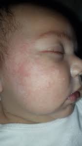 sino same ko na sinasabihan maselan daw ako dahil hindi ko daw  pinapahawakan si baby sa iba.. nagtatampo kasi yung lolo ng baby ko hindi  na daw nya nahahawakan at nkakarga..pero yung