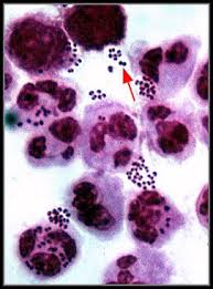 Yeast is a member of the fungus kingdom and is a cool experiment with your microscope. Lab Manual Exercise 1