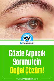 Gozde Arpacik Sorunu Icin Dogal Cozum Faydali Bilgin Dogal Dogal Tedaviler Saglik
