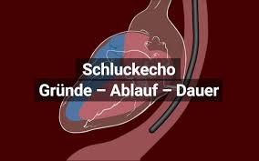 Maybe you would like to learn more about one of these? Transosophageale Echokardiographie Tte Ablauf Und Dauer