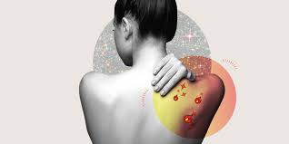 Jun 09, 2019 · how to stop sunburn itch fast use gentle moisturizers. How To Treat A Sunburn Quickly Sunburn Treatment And Relief Tips 2020