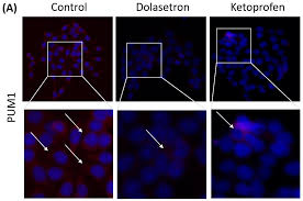Image result for Dolasetron