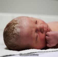 Don't bathe baby just after birth! Vernix Delayed Bathing And Breastfeeding La Lactation Llc