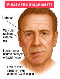 What's the diagnosis based