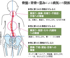 カイロプラクティックとは｜ゆうび施術院