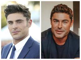 The zac efron plastic surgery really did wonders for this celebrity giving him a more attractive and mature appearance. Bf927w2vc5enjm