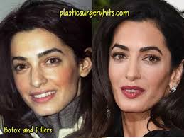 In der welt der promis ist immer etwas los. 120 Celebs Without Makeup Ideas Celebs Without Makeup Without Makeup Celebrity Plastic Surgery