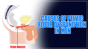 Image result for Pelvic Floor Dysfunction