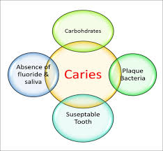 Factors In The Dental Caries Process Food For Thought The