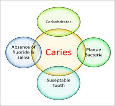 factors in the dental caries process food for thought the