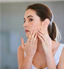 Sandra Clair: Is adult acne caused by our diets?