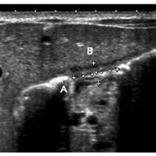 A mode is an operational state that a system has been switched to. Ultrasonographic Image Of The Normal Pylorus In A 3 Week Old Female A Download Scientific Diagram