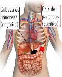 Biomagnetismo Curacion Con Imanes Pares Psicoemocionales Para Ayudar A Bajar De Peso Imanes Para Biomagnetismo Imanes Terapeuticos Acupuntura Para Adelgazar