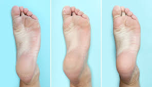 Fill the tub with lukewarm water. Baby Foot Peel Reviews Dupes And What To Know Before You Try It Self