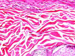 Dense Irregular Connective Tissue Histologyolm Stevegallik Org Tissue Types Loose Connective Tissue Microscopic Cells