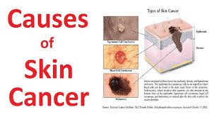 05.04.2019 · there's no questions that sun exposure increases your risk of skin cancer. Skin Cancer Surgery In Aligarh Skin Hair Expert