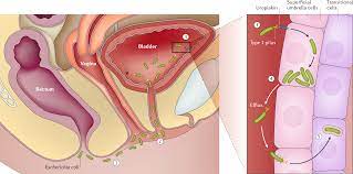 Nonantibiotic prevention and management of recurrent urinary tract infection  | Nature Reviews Urology