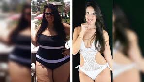 Según los autores del estudio, este ha sido el primer caso conocido. Viral Fotos Instagram Mira El Impresionante Antes Y Despues De Esta Mujer Tras Cirugia Foto 1 De 20 Internacionales Actualidad Peru Com