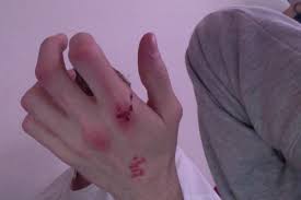 صور ايد مجروحه Makusia Images