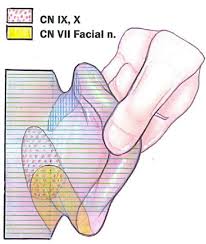 Image result for Ear Nerve Block